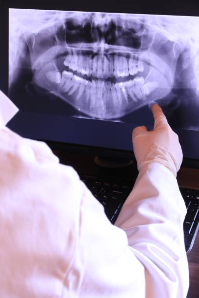 Best Cracked Tooth Emergency Dentist  in Indio, CA
