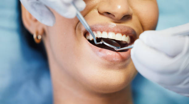 Tooth Infection Emergency Dentist in CA