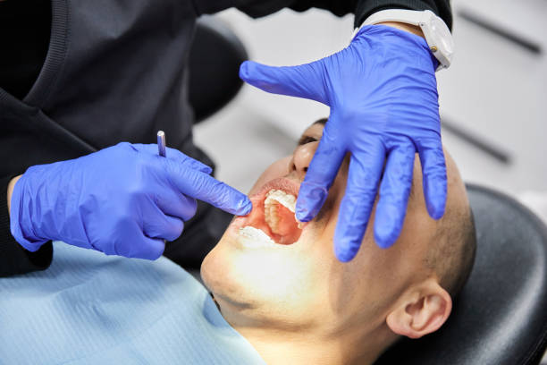 Best Dentist for Tooth Abscess  in Indio, CA